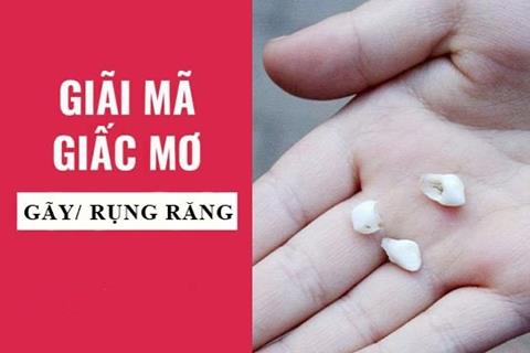 Nằm mơ thấy rụng răng là điềm gì, hên hay xui, đánh con gì?