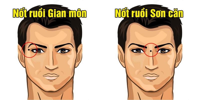 GameNhanh.Com - Xem tướng vị trí nốt ruồi đen đủi trên mặt Nam & Nữ nên xóa 8