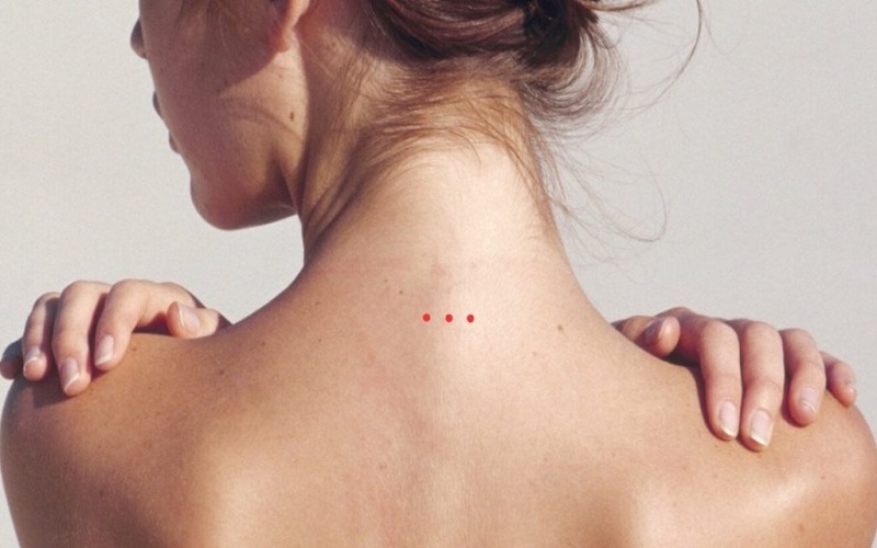 3 nốt ruồi sau gáy nữ được coi là một dấu hiệu cho thấy tuổi trẻ của bạn sẽ đầy khó khăn và gian truân