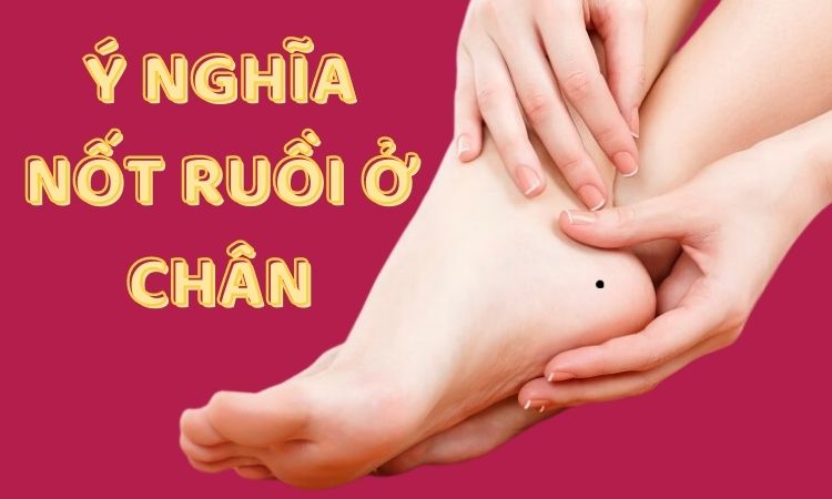 GameThuVi.Com - Nốt ruồi ở chân 3