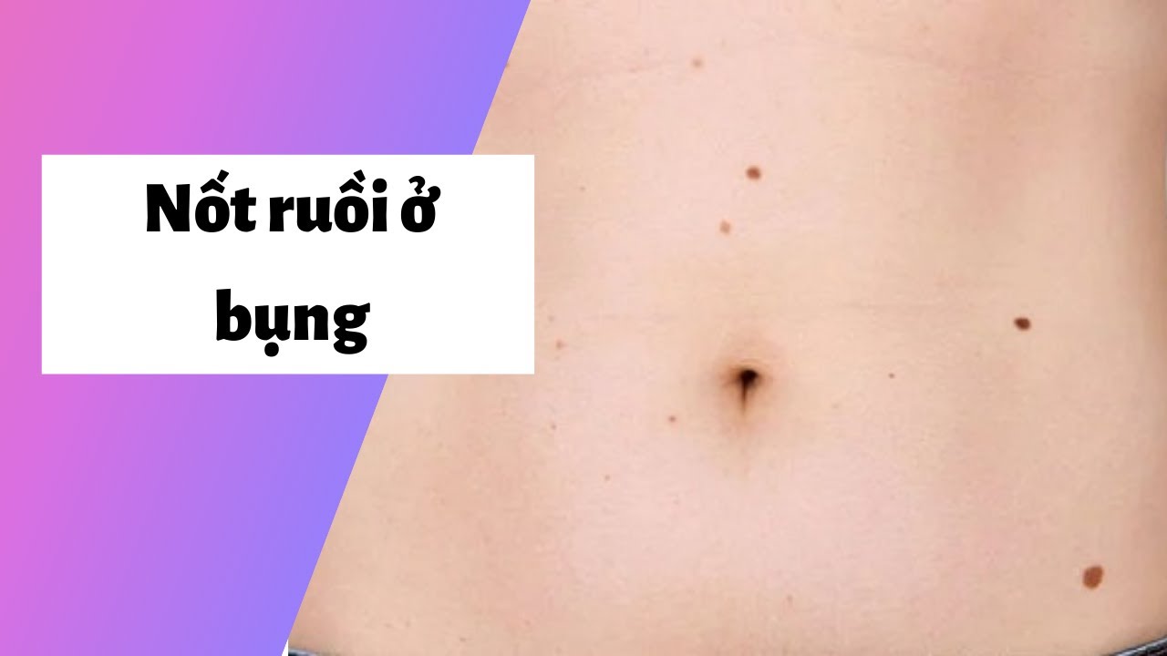 21220406 y nghia not ruoi o bung