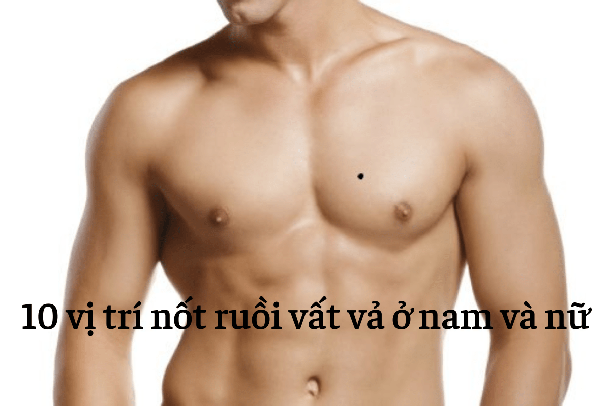 01151240-not-ruoi-vat-va