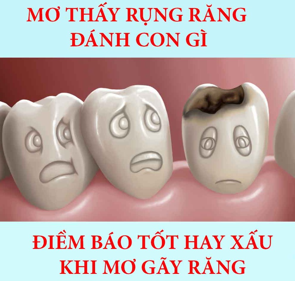 Nằm mơ thấy rụng răng là điềm gì, hên hay xui, đánh con gì? - TH Điện Biên Đông Nằm Mơ Thấy Rụng Răng Là Điềm Gì, Hên Hay Xui, Đánh Con Gì? - Th Điện Biên Đông