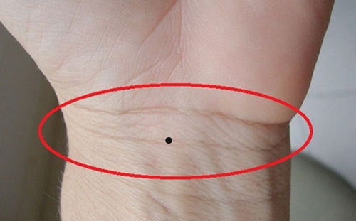 Nốt ruồi ở dưới cổ tay được xem là “nốt ruồi ở cổ tay ăn vay cả đời” 