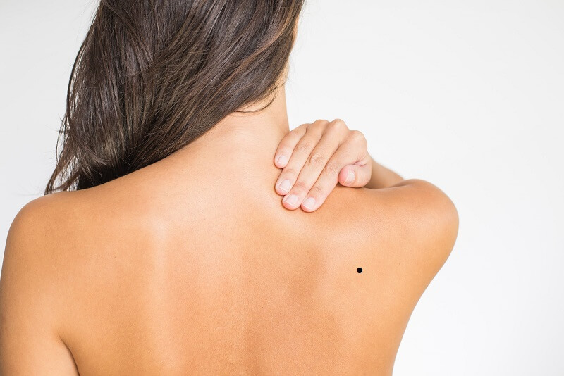 Nốt ruồi sau lưng phụ nữ có vị trí bên phải thường gặp nhiều may mắn 