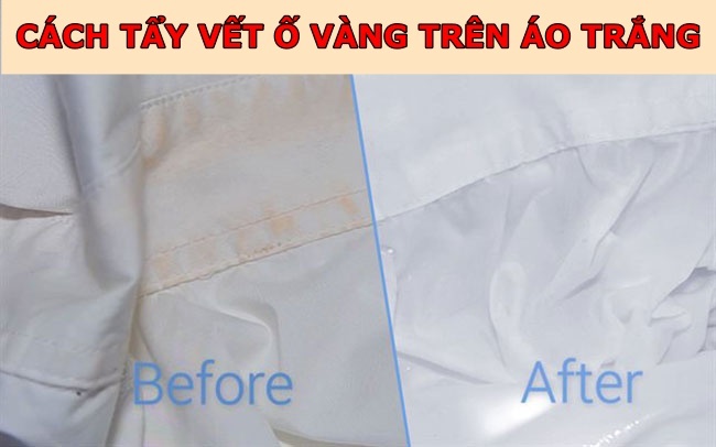 [Mẹo] 7 cách tẩy áo trắng bị ngả màu ố vàng (Trắng đẹp lại như mới)