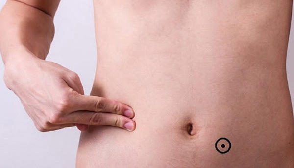 Nốt ruồi dưới rốn nam giới tướng số có người lo ăn, lo mặc, sống sung túc đến hết đời.