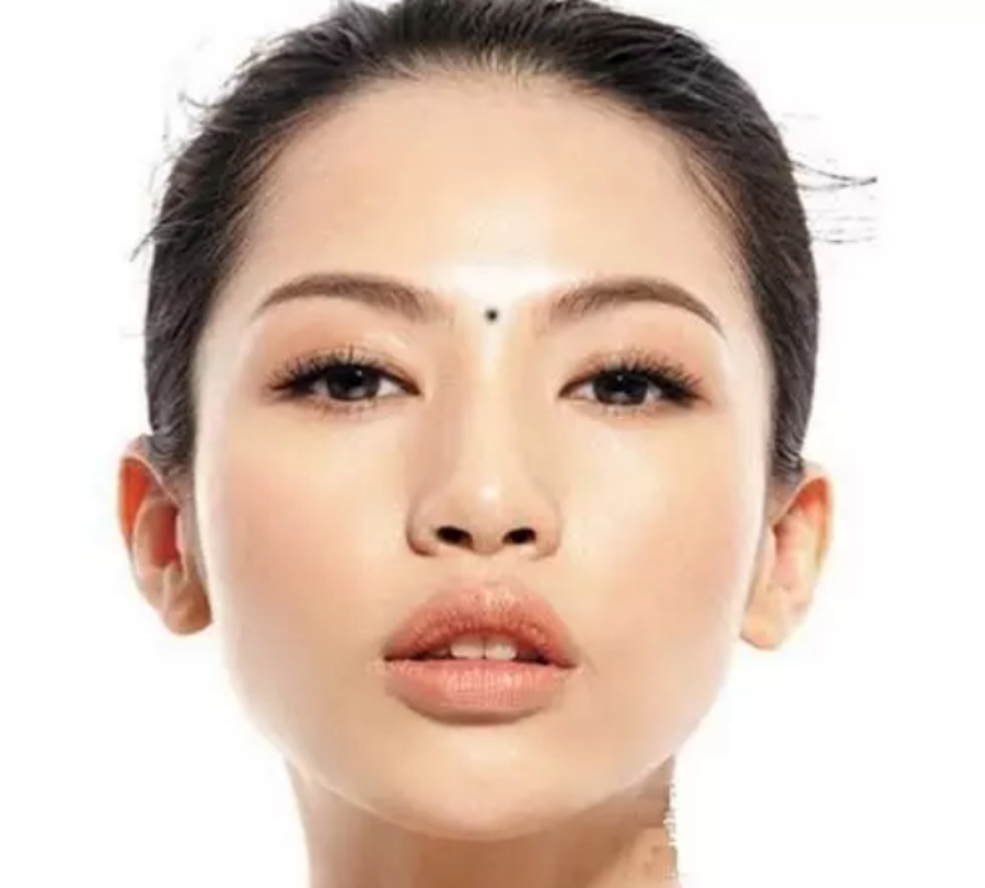 GameThuVi.Com - Nốt ruồi trên trán 16