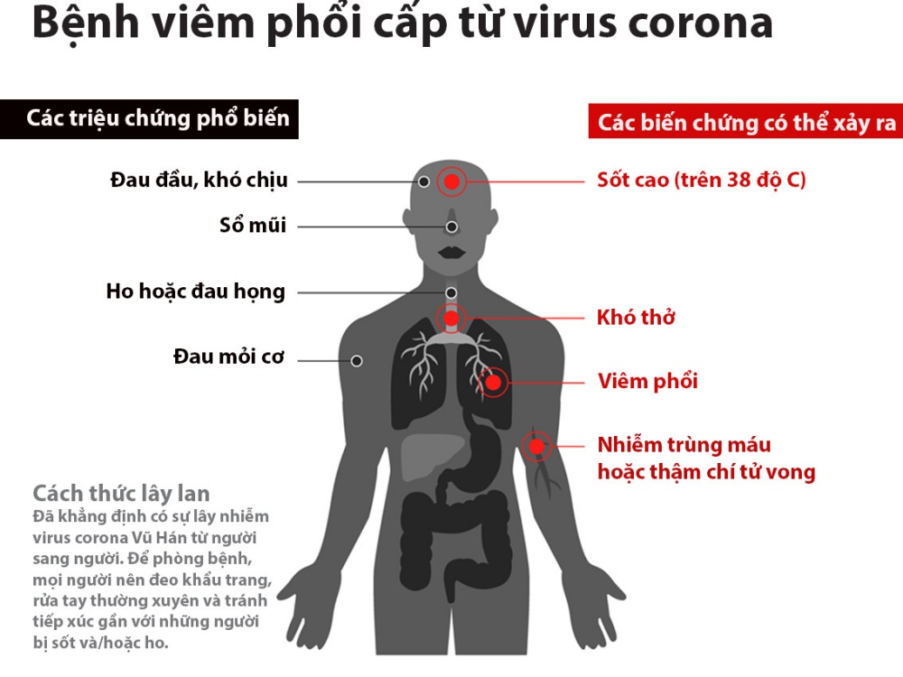 Triệu chứng bệnh viên phối cấp từ virus Corona
